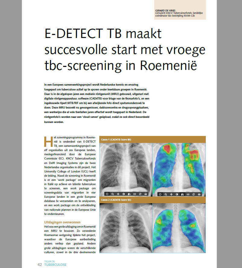 E-DETECT featured in special edition of Tegen de Tuberculose